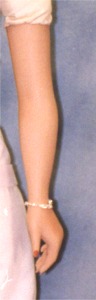 Left Arm #4