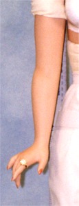 Right Arm #4